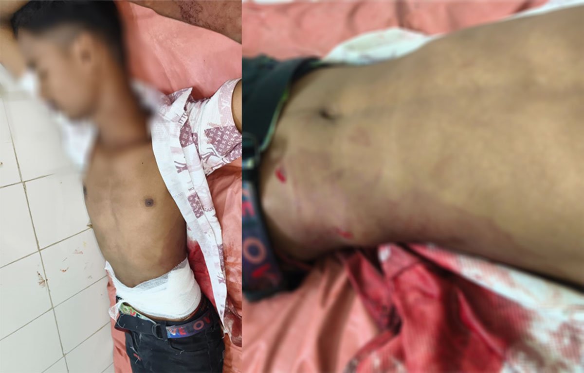 सगे भाइयों पर हमला