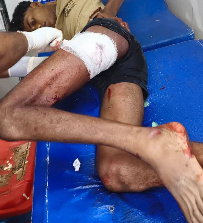 सगे भाइयों पर हमला
